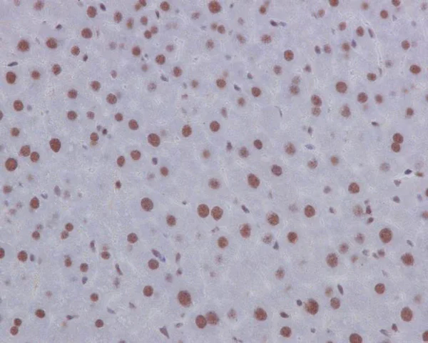 Immunohistochemistry (Formalin/PFA-fixed paraffin-embedded sections) - Anti-p130 antibody [EP2141Y] - BSA and Azide free (AB247453)