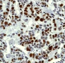 Immunohistochemistry (Formalin/PFA-fixed paraffin-embedded sections) - Anti-p130 antibody [EP2141Y] - BSA and Azide free (AB247453)