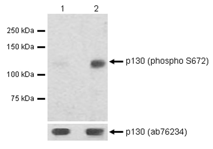 Western blot - Anti-p130 (phospho S672) antibody [EP2126Y] - BSA and Azide free (AB284755), expandable thumbnail