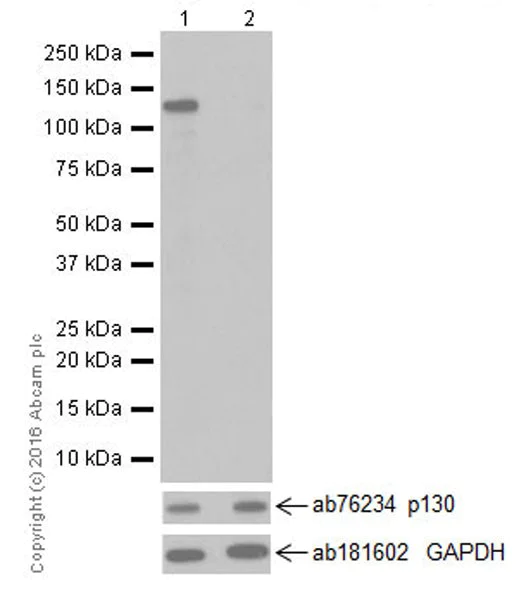 Western blot - Anti-p130 (phospho T986) antibody [EPR2389(2)] (AB211928)