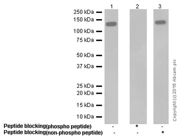 Western blot - Anti-p130 (phospho T986) antibody [EPR2389(2)] (AB211928)