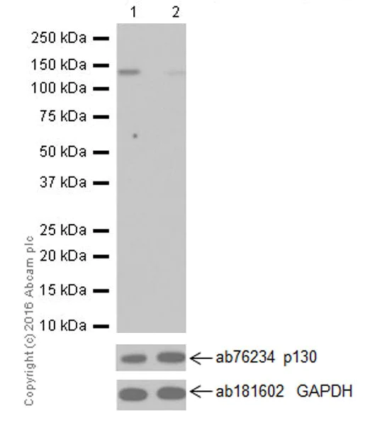 Western blot - Anti-p130 (phospho T986) antibody [EPR2389(2)] - BSA and Azide free (AB251534)