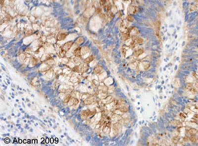 Immunohistochemistry (Formalin/PFA-fixed paraffin-embedded sections) - Anti-p15 INK4b antibody (AB53034)