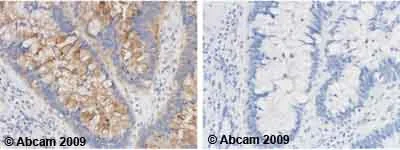 Immunohistochemistry (Formalin/PFA-fixed paraffin-embedded sections) - Anti-p15 INK4b antibody (AB53034)