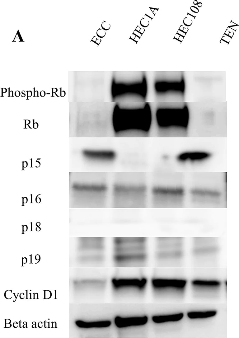 Western blot - Anti-p15 INK4b antibody (AB53034)