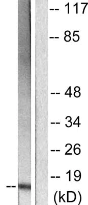 Western blot - Anti-p15 INK4b antibody (AB53034)