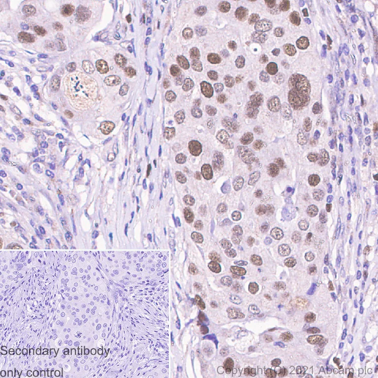 Immunohistochemistry (Formalin/PFA-fixed paraffin-embedded sections) - Anti-p150 CAF1/CAF antibody [EPR5576(2)] - BSA and Azide free (AB232030)
