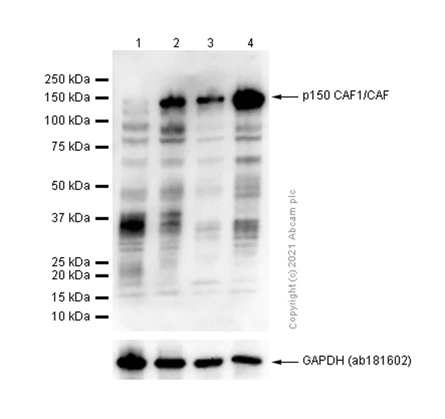 Western blot - Anti-p150 CAF1/CAF antibody [EPR5576(2)] - BSA and Azide free (AB232030)