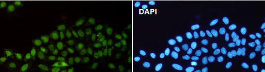 Immunocytochemistry/ Immunofluorescence - Anti-p150 CAF1/CAF antibody [SR3897] (AB326699)