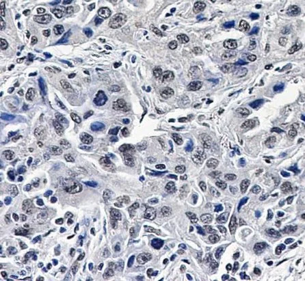 Immunohistochemistry (Formalin/PFA-fixed paraffin-embedded sections) - Anti-p150 CAF1/CAF antibody [SR3897] (AB326699)