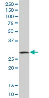 Western blot - Anti-P15RS antibody (AB88304)
