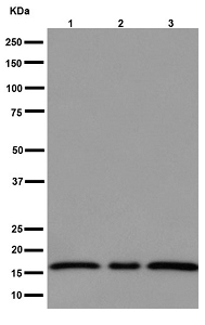 Western blot - Anti-p18 INK4c/CDKN2C antibody [EPR15891] (ab192239), expandable thumbnail