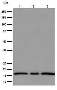 Western blot - Anti-p18 INK4c/CDKN2C antibody [EPR15891] (AB192239)