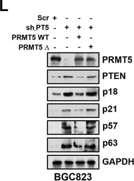 Western blot - Anti-p18 INK4c/CDKN2C antibody [EPR15891] (AB192239)