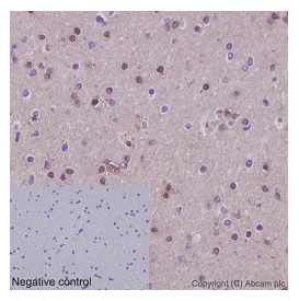 Immunohistochemistry (Formalin/PFA-fixed paraffin-embedded sections) - Anti-p18 INK4c/CDKN2C antibody [EPR15891] - BSA and Azide free (AB232631)