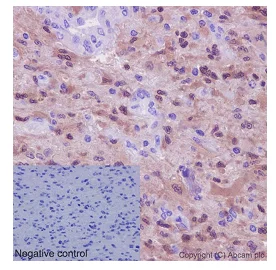 Immunohistochemistry (Formalin/PFA-fixed paraffin-embedded sections) - Anti-p18 INK4c/CDKN2C antibody [EPR15891] - BSA and Azide free (AB232631)