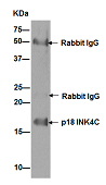 Immunoprecipitation - Anti-p18 INK4c/CDKN2C antibody [EPR15891] - BSA and Azide free (AB232631), expandable thumbnail