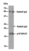 Immunoprecipitation - Anti-p18 INK4c/CDKN2C antibody [EPR15891] - BSA and Azide free (AB232631)