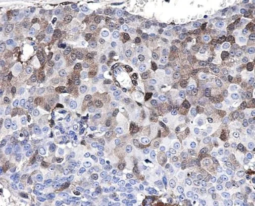 Immunohistochemistry (Formalin/PFA-fixed paraffin-embedded sections) - Anti-p18 INK4c/CDKN2C antibody [SR1208] (AB326689)