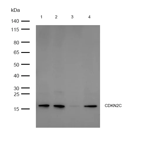 Western blot - Anti-p18 INK4c/CDKN2C antibody [SR1208] (AB326689)