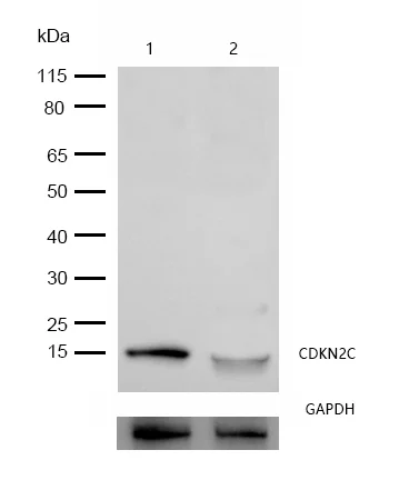 Western blot - Anti-p18 INK4c/CDKN2C antibody [SR1208] (AB326689)