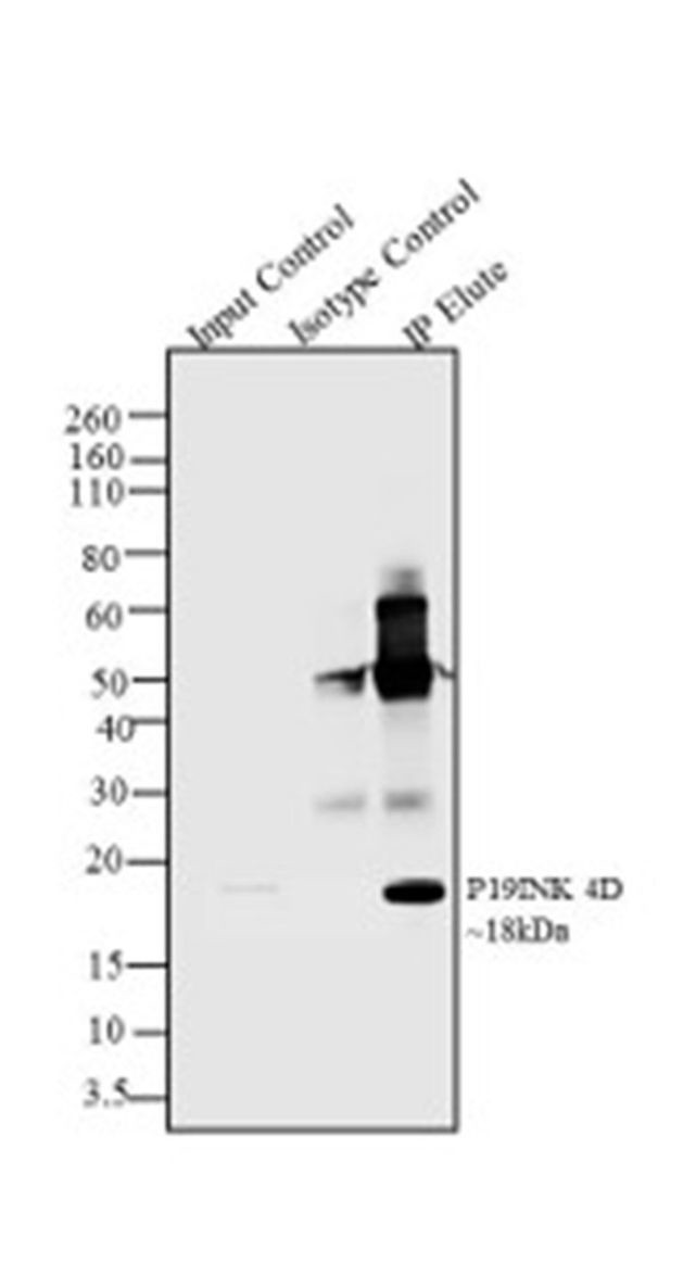 Immunoprecipitation - Anti-p19 INK4d antibody [RP23040113] (AB308000), expandable thumbnail