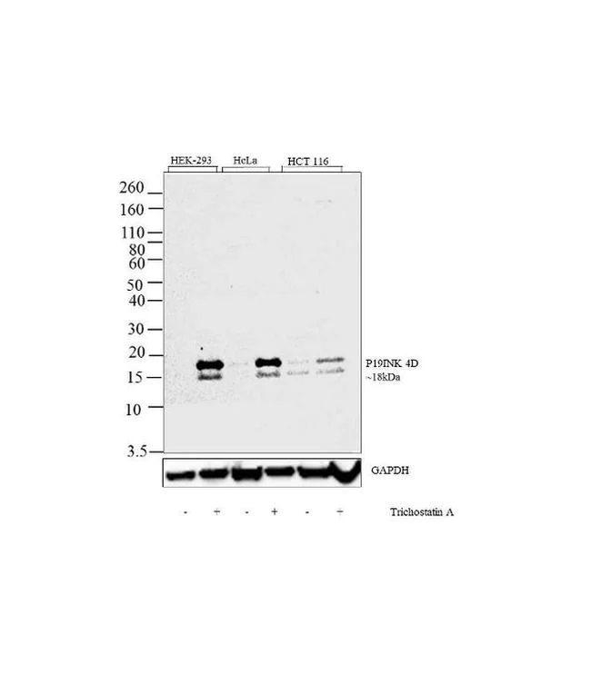 Western blot - Anti-p19 INK4d antibody [RP23040113] (AB308000)