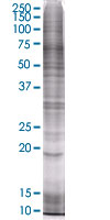 SDS-PAGE - p19 INK4d overexpression 293T lysate (whole cell) (AB94314), expandable thumbnail