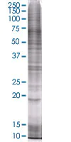 SDS-PAGE - p19 INK4d overexpression 293T lysate (whole cell) (AB94314)