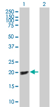 Western blot - p19 INK4d overexpression 293T lysate (whole cell) (AB94314), expandable thumbnail