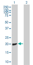 Western blot - p19 INK4d overexpression 293T lysate (whole cell) (AB94314)
