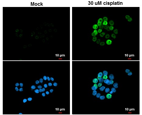 Immunocytochemistry/ Immunofluorescence - Anti-p21 antibody (AB227443)
