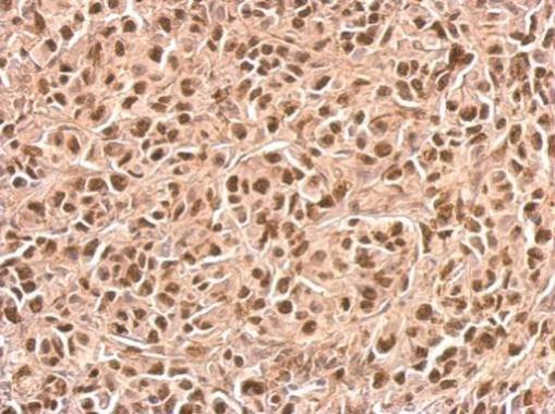 Immunohistochemistry (Formalin/PFA-fixed paraffin-embedded sections) - Anti-p21 antibody (AB227443)