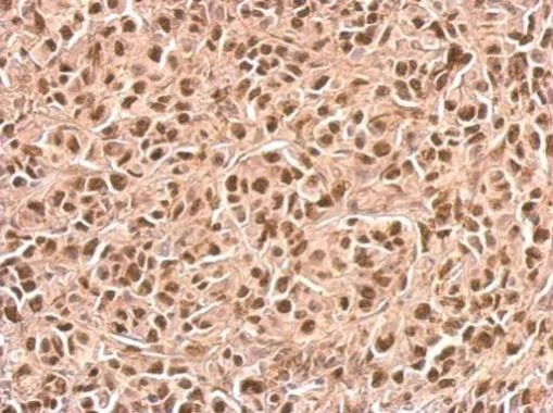 Immunohistochemistry (Formalin/PFA-fixed paraffin-embedded sections) - Anti-p21 antibody (AB227443)