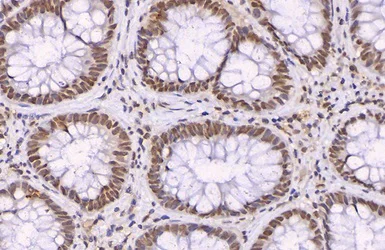 Immunohistochemistry (Formalin/PFA-fixed paraffin-embedded sections) - Anti-p21 antibody (AB227443)