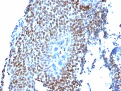 Immunohistochemistry (Formalin/PFA-fixed paraffin-embedded sections) - Anti-p21 antibody [CIP1/823] (AB220206), expandable thumbnail