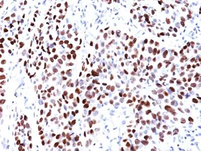 Immunohistochemistry (Formalin/PFA-fixed paraffin-embedded sections) - Anti-p21 antibody [CIP1/823] (AB220206)