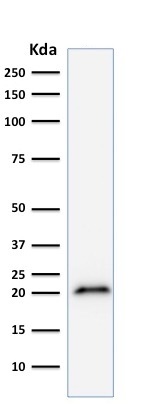 Western blot - Anti-p21 antibody [CIP1/823] (AB220206), expandable thumbnail