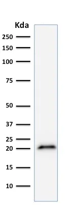 Western blot - Anti-p21 antibody [CIP1/823] (AB220206)