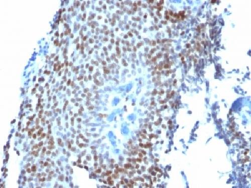 Immunohistochemistry (Formalin/PFA-fixed paraffin-embedded sections) - Anti-p21 antibody [CIP1/823] - BSA and Azide free (AB212247), expandable thumbnail