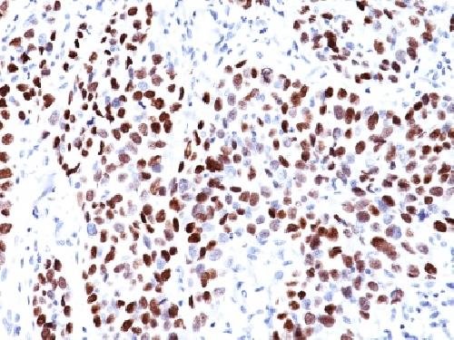 Immunohistochemistry (Formalin/PFA-fixed paraffin-embedded sections) - Anti-p21 antibody [CIP1/823] - BSA and Azide free (AB212247), expandable thumbnail