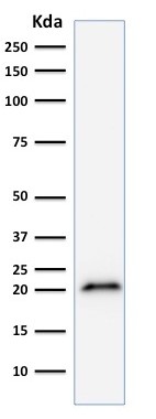 Western blot - Anti-p21 antibody [CIP1/823] - BSA and Azide free (AB212247), expandable thumbnail