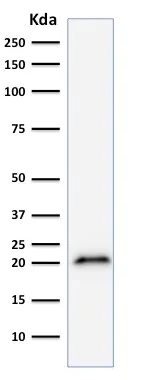 Western blot - Anti-p21 antibody [CIP1/823] - BSA and Azide free (AB212247)