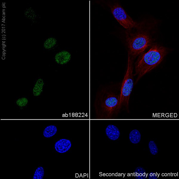 Immunocytochemistry/ Immunofluorescence - Anti-p21 antibody [EPR18021] (ab188224), expandable thumbnail