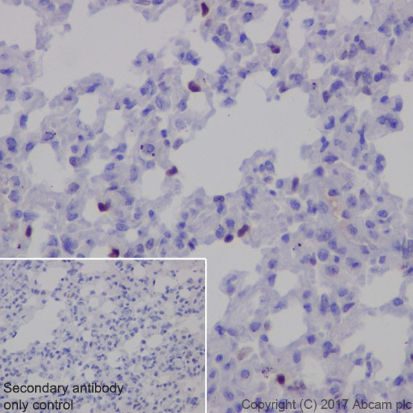 Immunohistochemistry (Formalin/PFA-fixed paraffin-embedded sections) - Anti-p21 antibody [EPR18021] (ab188224), expandable thumbnail