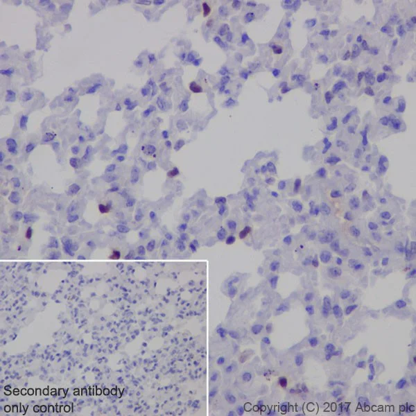Immunohistochemistry (Formalin/PFA-fixed paraffin-embedded sections) - Anti-p21 antibody [EPR18021] (AB188224)