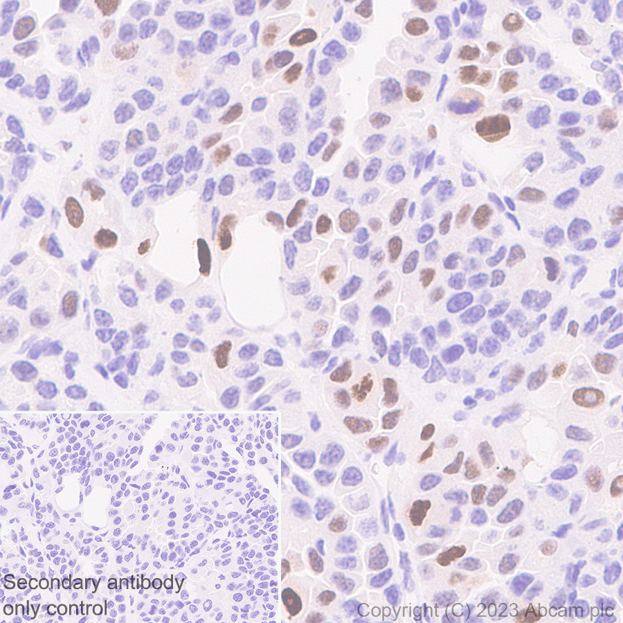 Immunohistochemistry (Formalin/PFA-fixed paraffin-embedded sections) - Anti-p21 antibody [EPR18021] (ab188224), expandable thumbnail