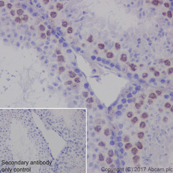 Immunohistochemistry (Formalin/PFA-fixed paraffin-embedded sections) - Anti-p21 antibody [EPR18021] (AB188224), expandable thumbnail