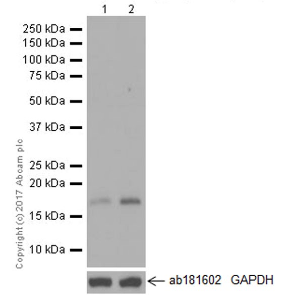 Western blot - Anti-p21 antibody [EPR18021] (AB188224), expandable thumbnail