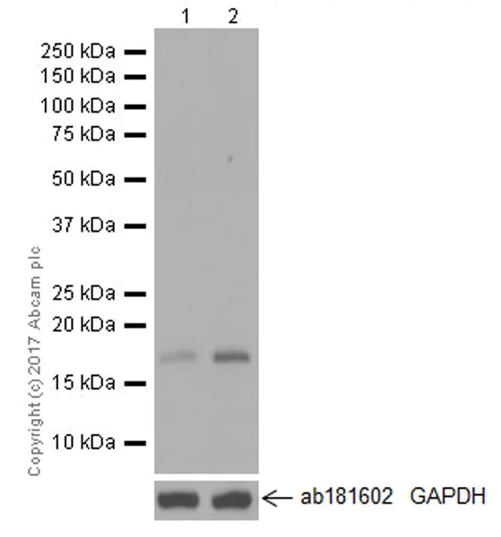 Western blot - Anti-p21 antibody [EPR18021] (AB188224)